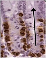 Innate immunity in the large intestine - Figure 1